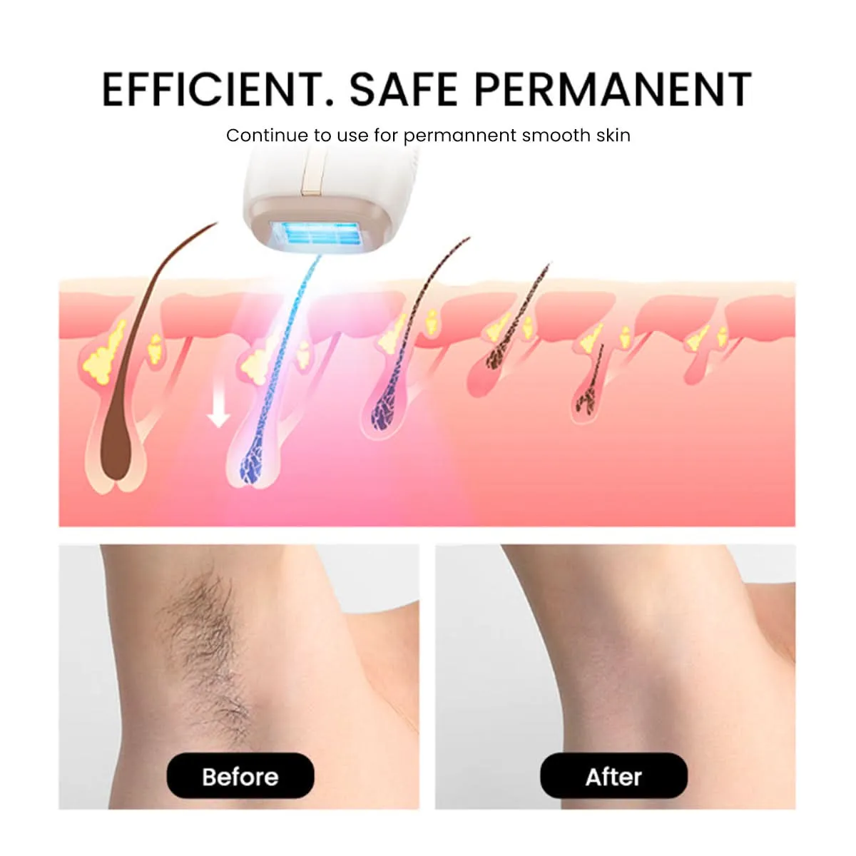 AMIRO IceSmooth Hair Removal IPL Device