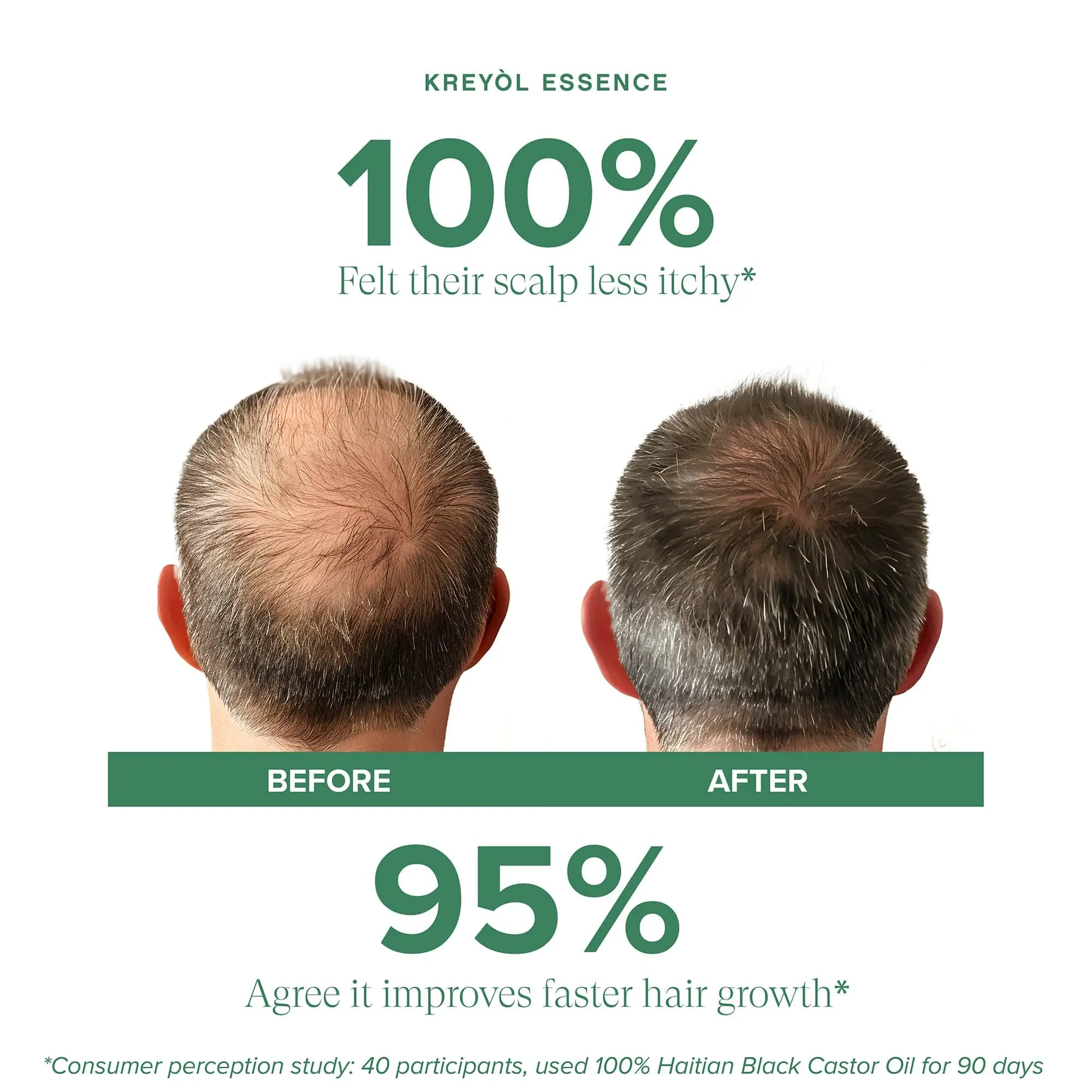 Clinically Proven Hair Growth Duo